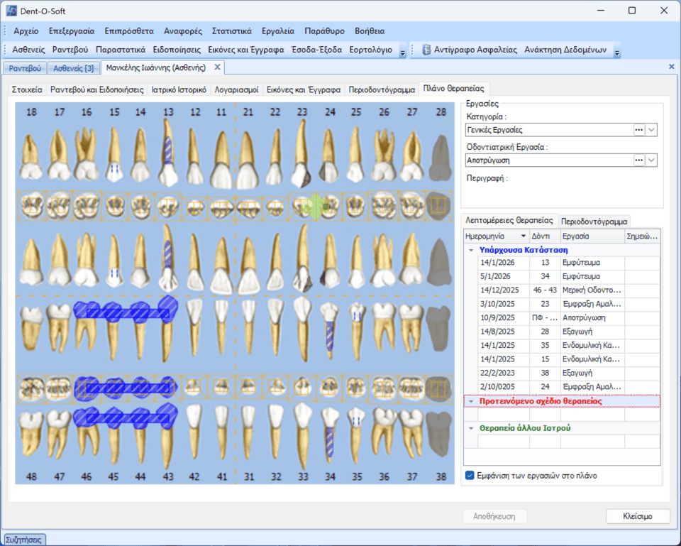 Οδοντόγραμμα